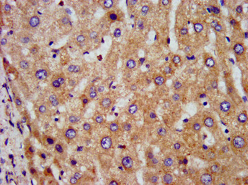 DLST Antibody