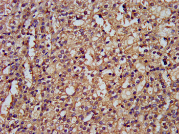 DLST Antibody
