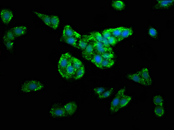 DLST Antibody