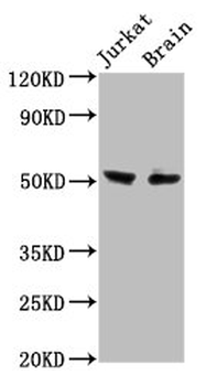 ONECUT1 Antibody