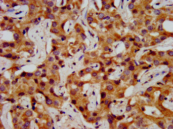 ONECUT1 Antibody