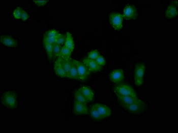 DMGDH Antibody