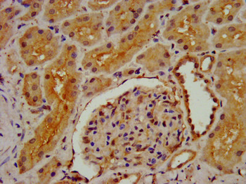 DMGDH Antibody