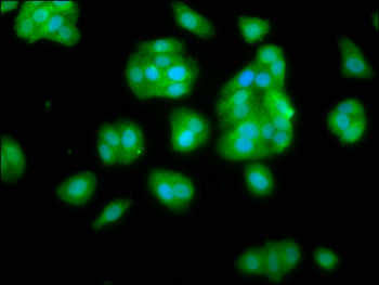 NANS Antibody