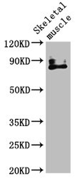 TRPV2 Antibody