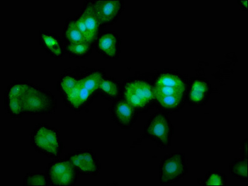 TRPV2 Antibody