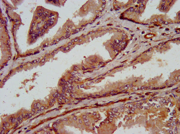 TRPV2 Antibody