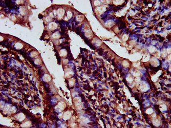 CDR2L Antibody