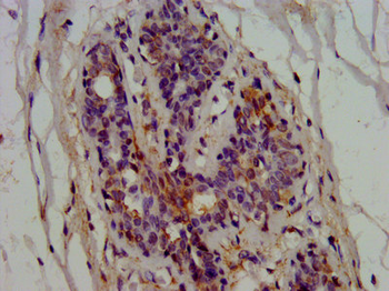 EPRS Antibody