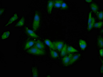 EPRS Antibody