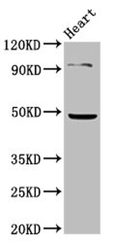 KCNJ5 Antibody