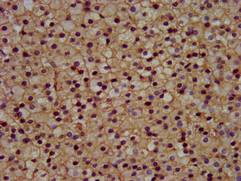 KCNJ5 Antibody