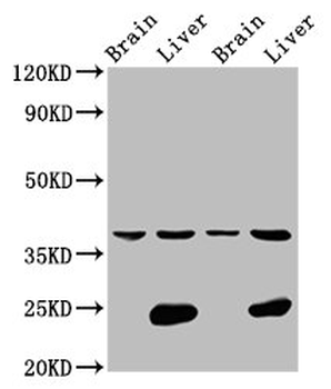 LSAMP Antibody