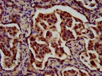 RFX1 Antibody