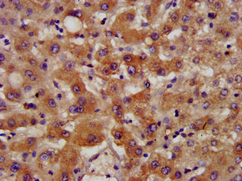 NSDHL Antibody