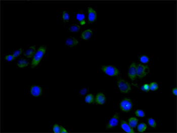 RPE65 Antibody