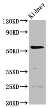 PIGW Antibody