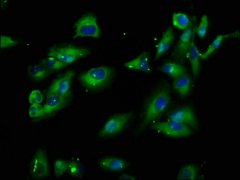 PIK3IP1 Antibody