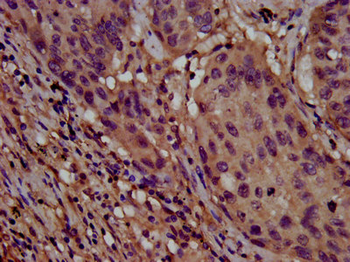 CLPTM1L Antibody