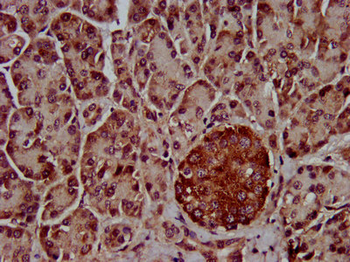 CLPTM1L Antibody