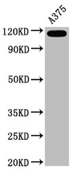 MCAM Antibody