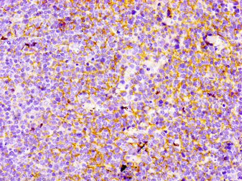 CR2 Antibody
