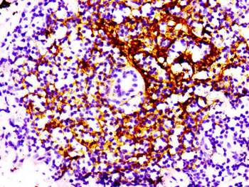 CR2 Antibody
