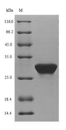 Mouse Pdk4 protein
