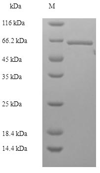 Human BRCC3 protein