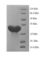 Rat CA1 protein
