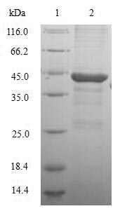 Human DHODH protein