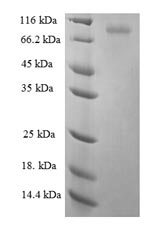 Human KRT6A protein