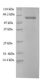 Human KRT6A protein