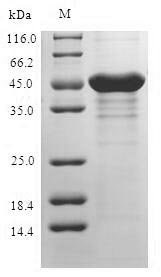 Human RS1 protein