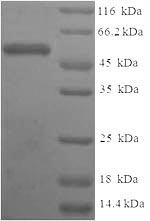 Human SULT1A3 protein