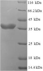 E. coli LPTC protein