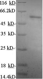 Human Estrogen Receptor beta protein