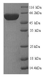 Human GP1BA protein