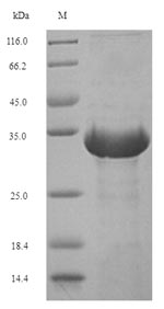 Reptile EURM2 protein