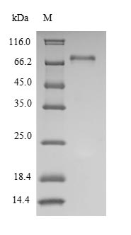 Human LCK protein