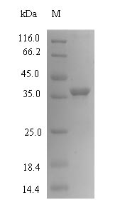 Mouse CMPK1 protein