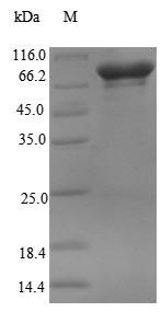 Human RBM14 protein