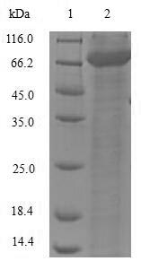 Mouse DCT protein