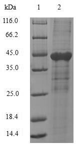 Human CEACAM1 protein