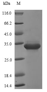 E. coli PHOP protein