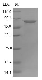 Human ATP5A1 protein