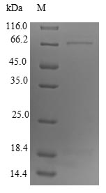 Mouse DCT protein