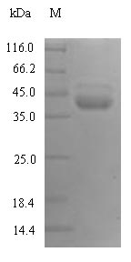 Human KLKB1 protein