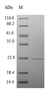 Mouse CTDP1 protein