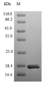 Human SLC5A2 protein